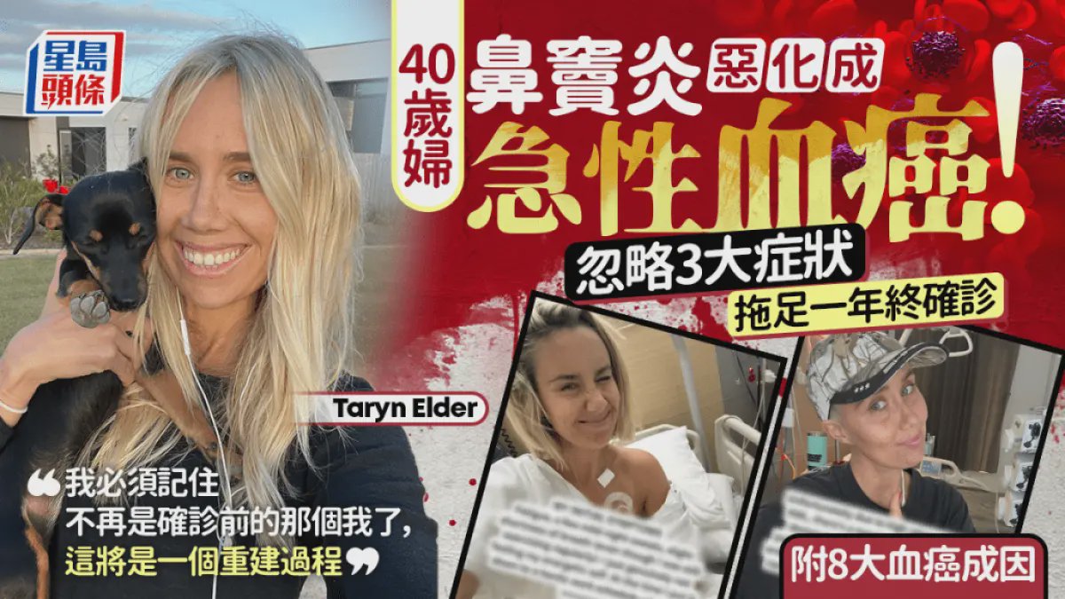 40歲婦鼻竇炎惡化成急性血癌！忽略3大症狀拖足一年終確診