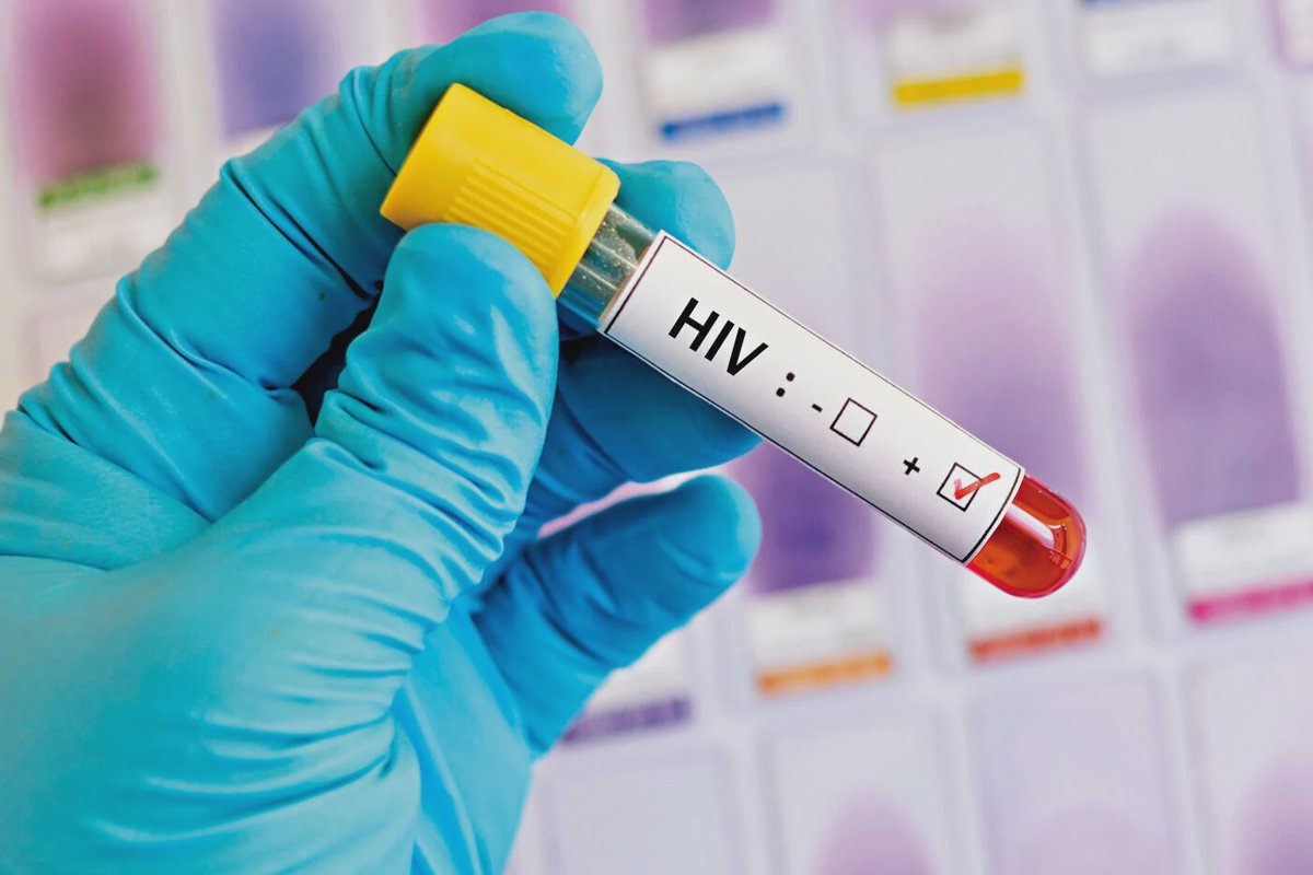 確診HIV即日治療減傳播