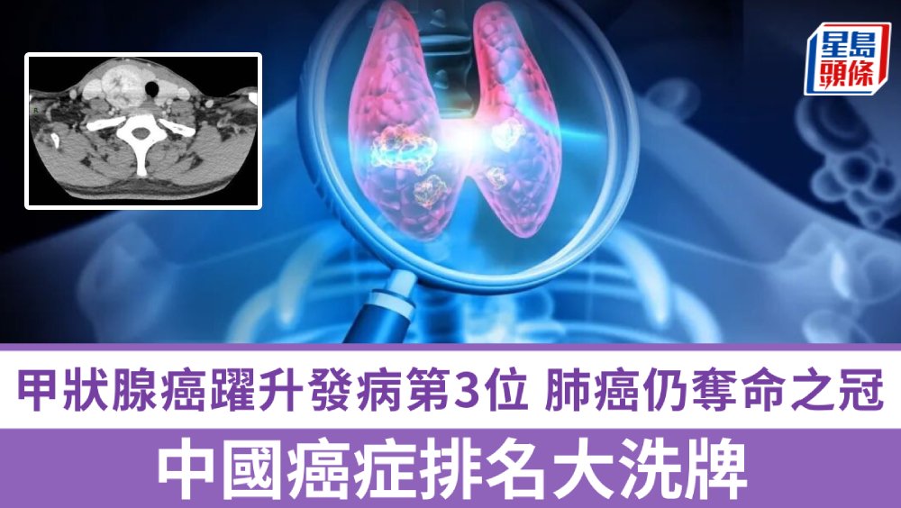 中國癌症排名大洗牌