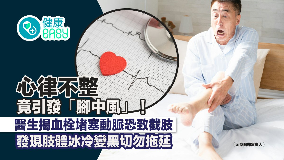 心律不整竟引發「腳中風」 6症狀是警號 腳變黑且疼痛要注意