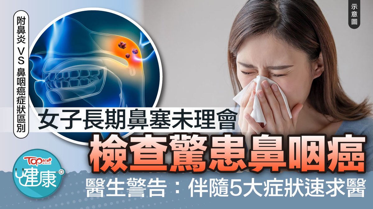 鼻咽癌｜女子長期鼻塞未理會檢查驚患鼻咽癌