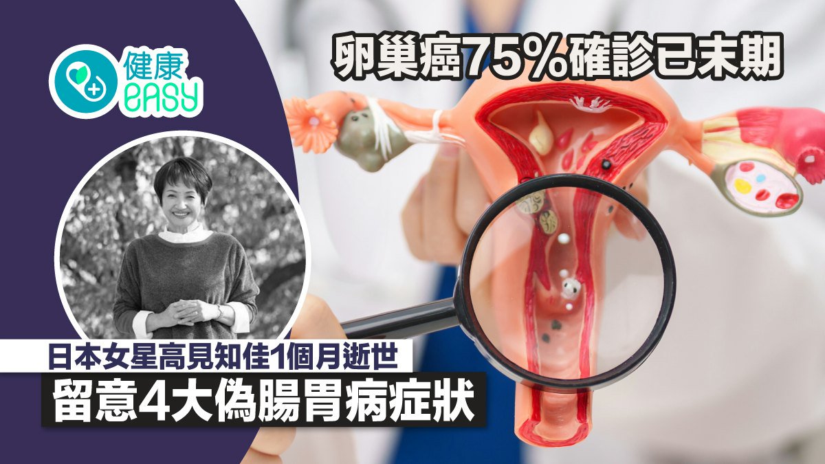 卵巢癌75%確診已末期 日本女星1個月逝世 留意4大偽腸胃病症狀