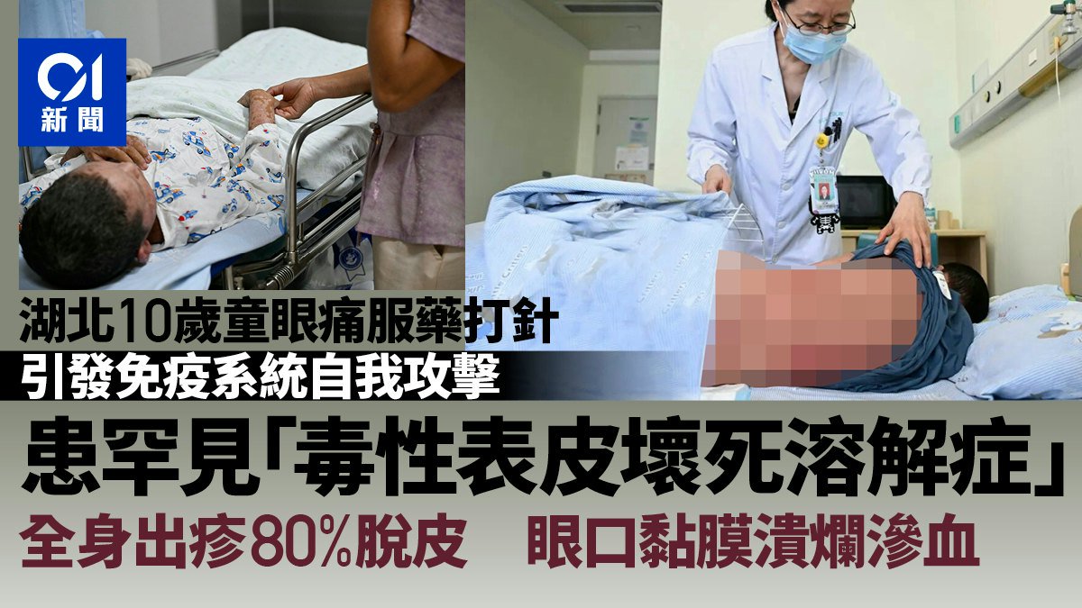 湖北10歲仔罕見TEN